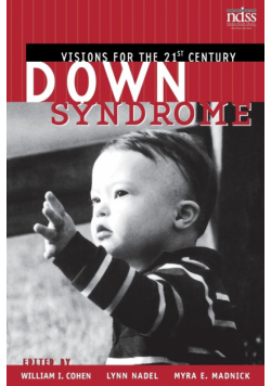 Down Syndrome
