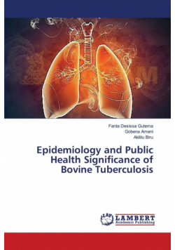 Epidemiology and Public Health Significance of Bovine Tuberculosis