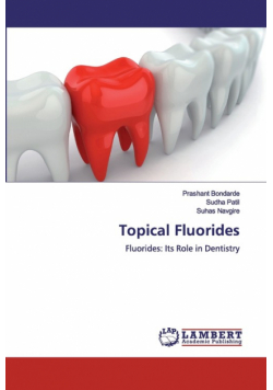 Topical Fluorides