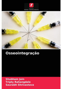 Osseointegração