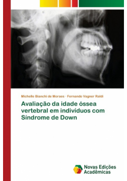 Avaliação da idade óssea vertebral em indivíduos com Síndrome de Down