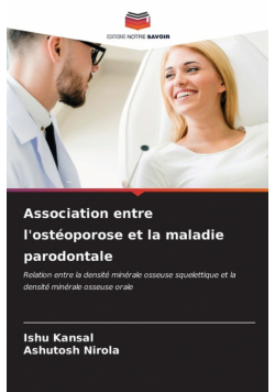 Association entre l'ostéoporose et la maladie parodontale