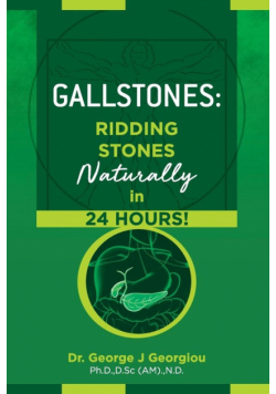 Gallstones
