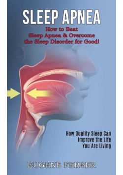 Sleep Apnea