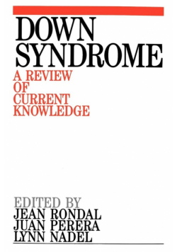 Down Syndrome