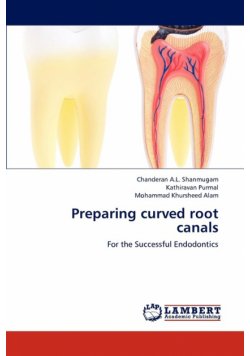 Preparing curved root canals