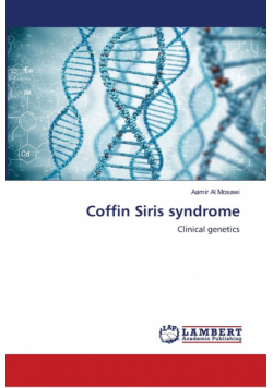 Coffin Siris syndrome