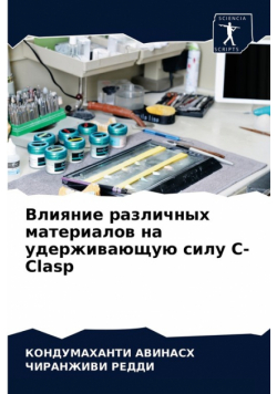 Влияние различных материалов на удерживающую силу C-Clasp