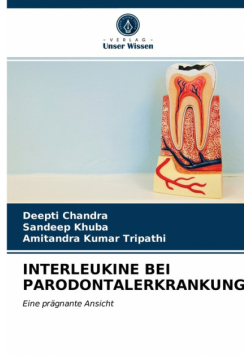 Interleukine Bei Parodontalerkrankungen