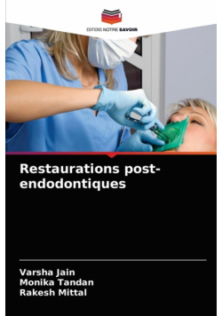 Restaurations post-endodontiques