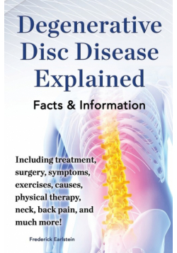 Degenerative Disc Disease Explained. Including Treatment, Surgery, Symptoms, Exercises, Causes, Physical Therapy, Neck, Back, Pain, and Much More! Fac