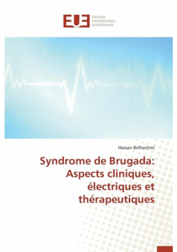 Syndrome de brugada