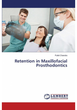 Retention in Maxillofacial Prosthodontics