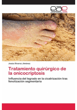 Tratamiento quirúrgico de la onicocriptosis