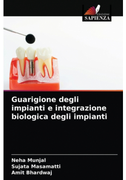 Guarigione degli impianti e integrazione biologica degli impianti