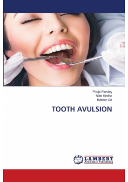 Tooth Avulsion