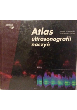 Atlas ultrasonografii naczyń z CD