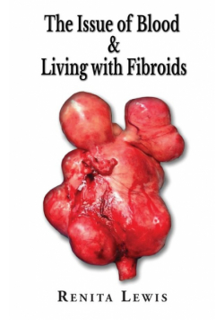 The Issue Of Blood & Living with Fibroids