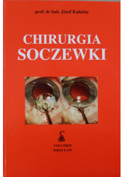 Chirurgia soczewki