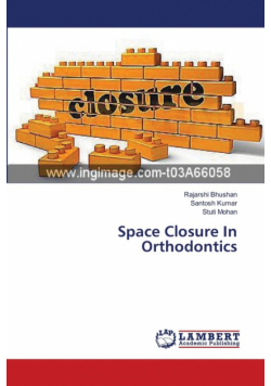 Space Closure In Orthodontics