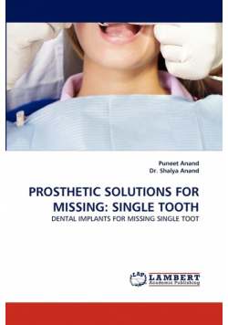 Prosthetic Solutions for Missing