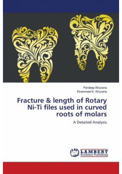 Fracture & length of Rotary Ni-Ti files used in curved roots of molars