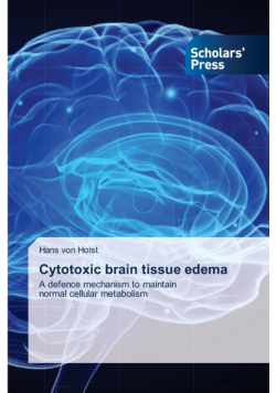 Cytotoxic brain tissue edema