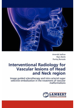 Interventional Radiology for Vascular Lesions of Head and Neck Region