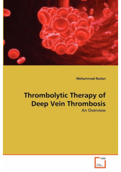 Thrombolytic Therapy of Deep Vein Thrombosis