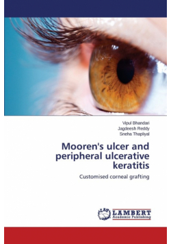 Mooren's ulcer and peripheral ulcerative keratitis