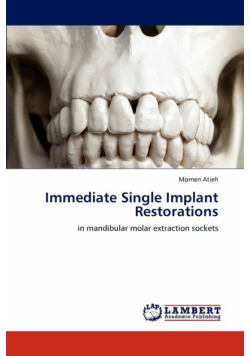 Immediate Single Implant Restorations