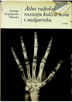 Atlas radiologiczny rozwoju kośćca dłoni i