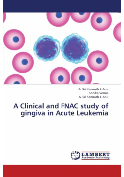 A Clinical and Fnac Study of Gingiva in Acute Leukemia