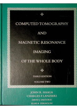 Computed tomography and magnetic resonance imaging of the whole body