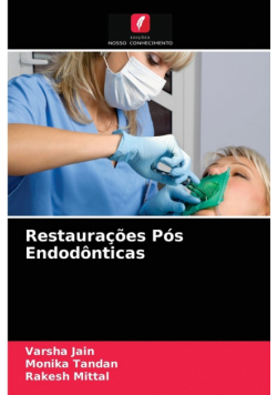 Restaurações Pós Endodônticas