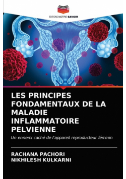 Les Principes Fondamentaux De La Maladie Inflammatoire Pelvienne