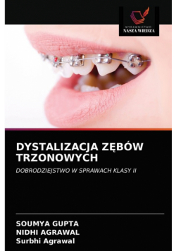 Dystalizacja Zębów Trzonowych