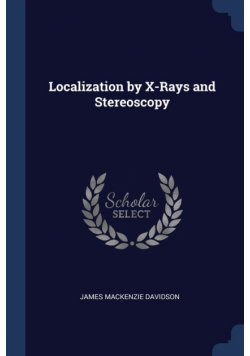 Localization by X-Rays and Stereoscopy