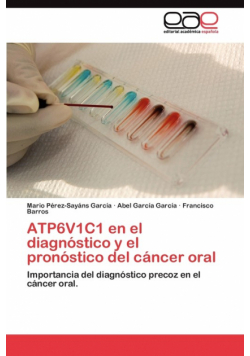 ATP6V1C1 en el diagnóstico y el pronóstico del cáncer oral