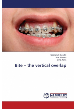 Bite - The Vertical Overlap