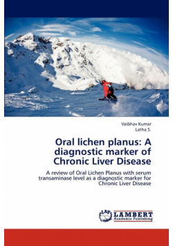Oral lichen planus