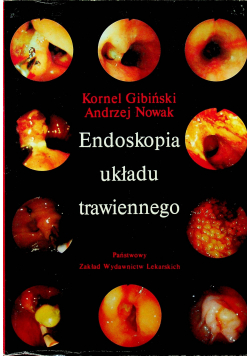 Endoskopia układu trawiennego