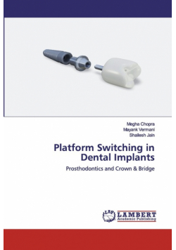 Platform Switching in Dental Implants