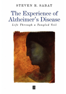 Experience Alzheimer Disease