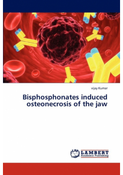 Bisphosphonates induced osteonecrosis of the jaw