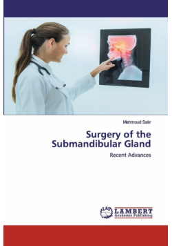 Surgery of the Submandibular Gland
