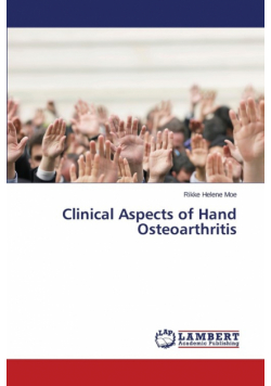Clinical Aspects of Hand Osteoarthritis