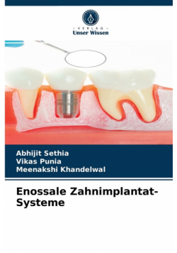 Enossale Zahnimplantat-Systeme