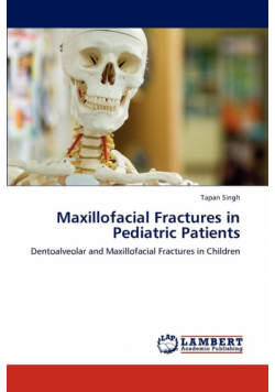 Maxillofacial Fractures in Pediatric Patients