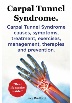 Carpal Tunnel Syndrome, Cts. Carpal Tunnel Syndrome Cts Causes, Symptoms, Treatment, Exercises, Management, Therapies and Prevention.